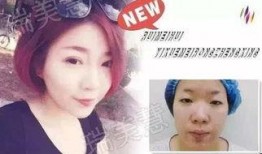 杭州整形爆料事件视频,揭秘美容行业潜规则与真实案例